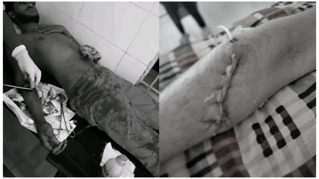 ধান কাটা কর্মসূচিতে অংশগ্রহণ : ছাত্রলীগ কর্মীকে বিএনপি নেতাকর্মীদের এলোপাথাড়ি কুপিয়ে হত্যাচেষ্টা