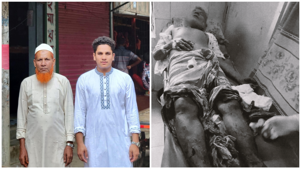 ছেলে ছাত্রলীগ করায় শরীয়তপুরে বাবাকে কুপিয়ে জখম, অভিযোগ বিএনপির বিরুদ্ধে