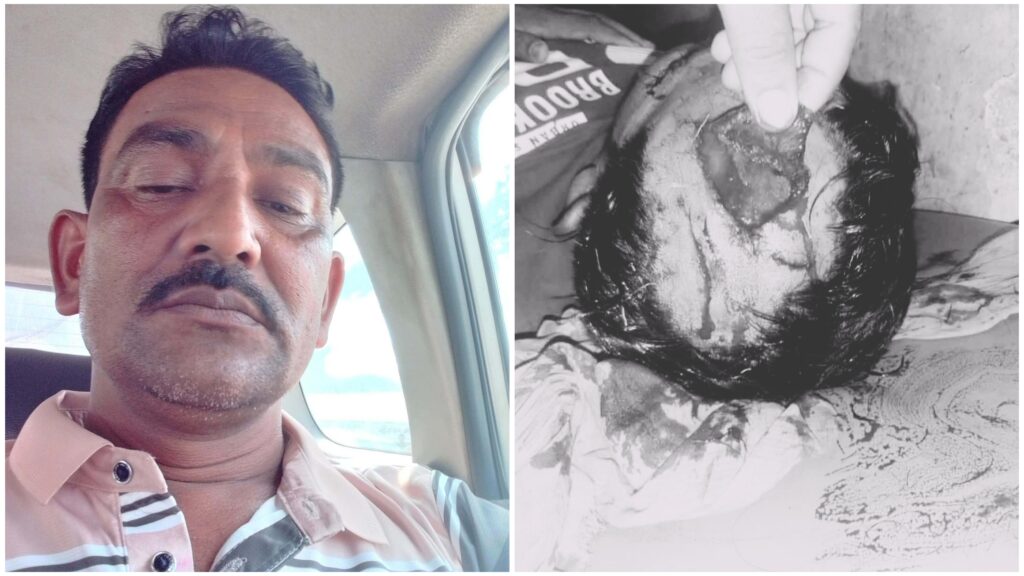 কুষ্টিয়ায় মাঠ থেকে ফেরার পথে আওয়ামী লীগ কর্মীকে কুপিয়ে জখম